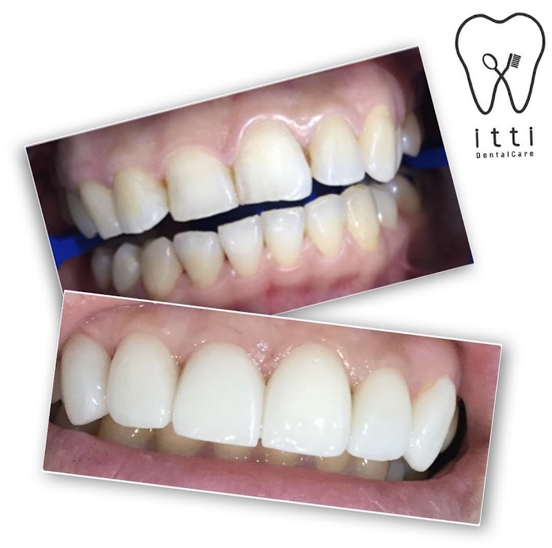 itti dental care silom